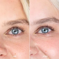 Sanzi beauty - Eye zone conditioner serum 8ml