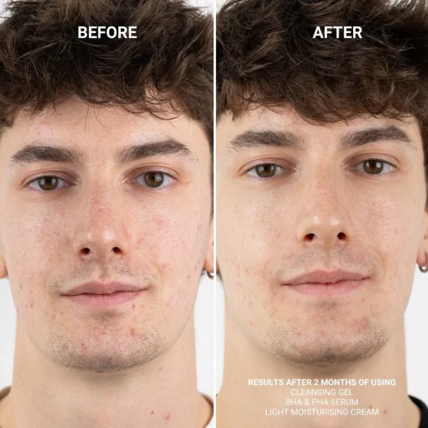 Sanzi beauty - BHA &amp; PHA serum 30ml