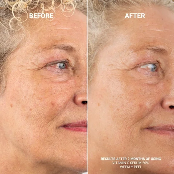 Sanzi beauty - Weekly peel with 28% AHA 2% BHA 30ml