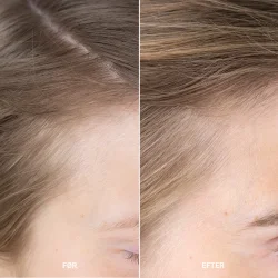 Sanzi beauty - Hair growth &amp; enhancing serum 120ml