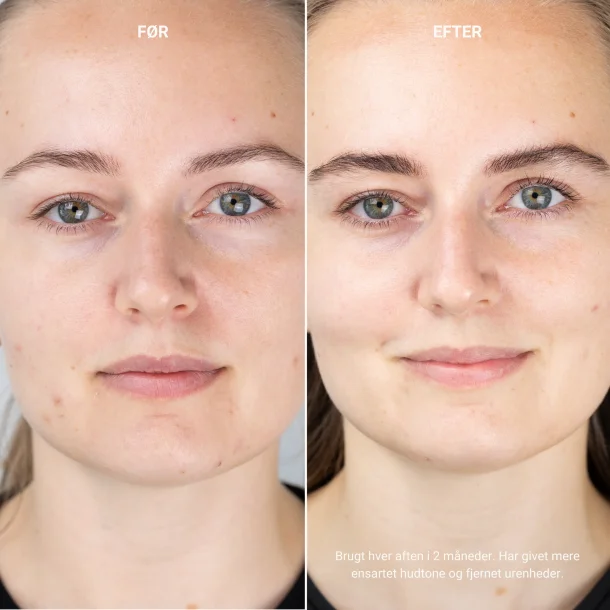 Sanzi Beauty - AHA peeling serum 10% 30ml 