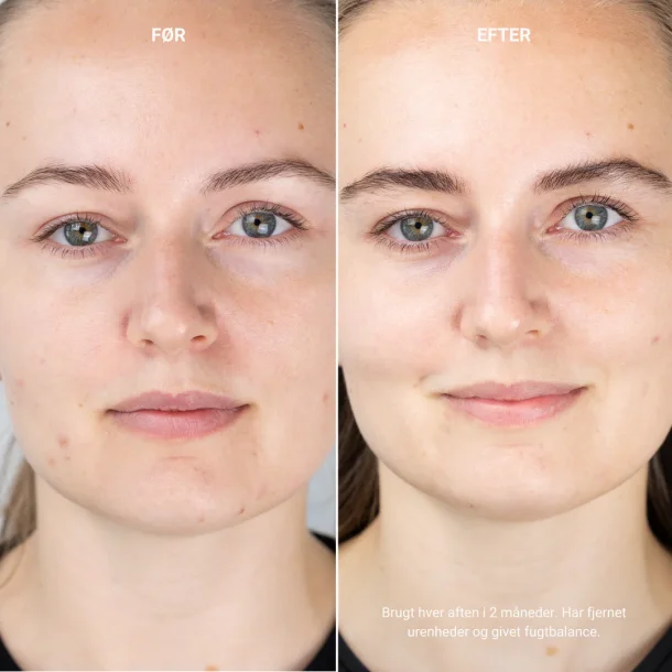 Sanzi beauty - Soft Cleansing foam 150ml