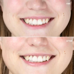 Sanzi beauty - Charcoal teeth withening 10g