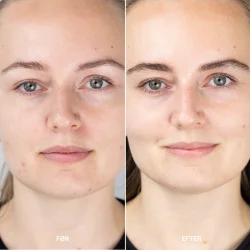 Sanzi beauty - Anti-aging lifting serum 30ml