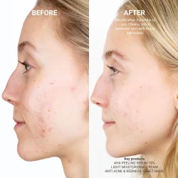 Sanzi Beauty - AHA peeling serum 10% 30ml 