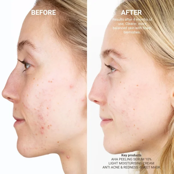 Sanzi Beauty - AHA peeling serum 10% 30ml 