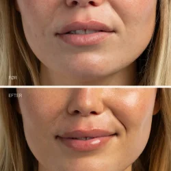 Sanzi beauty - Hydrating lip balm 15ml