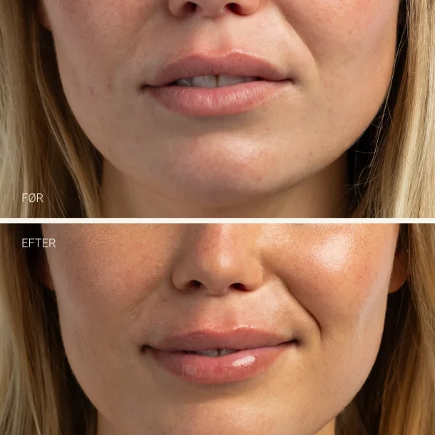 Sanzi beauty - Hydrating lip balm 15ml