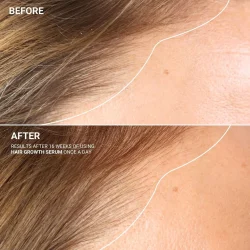 Sanzi beauty - Hair grow serum 120ml