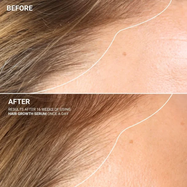 Sanzi beauty - Hair grow serum 120ml